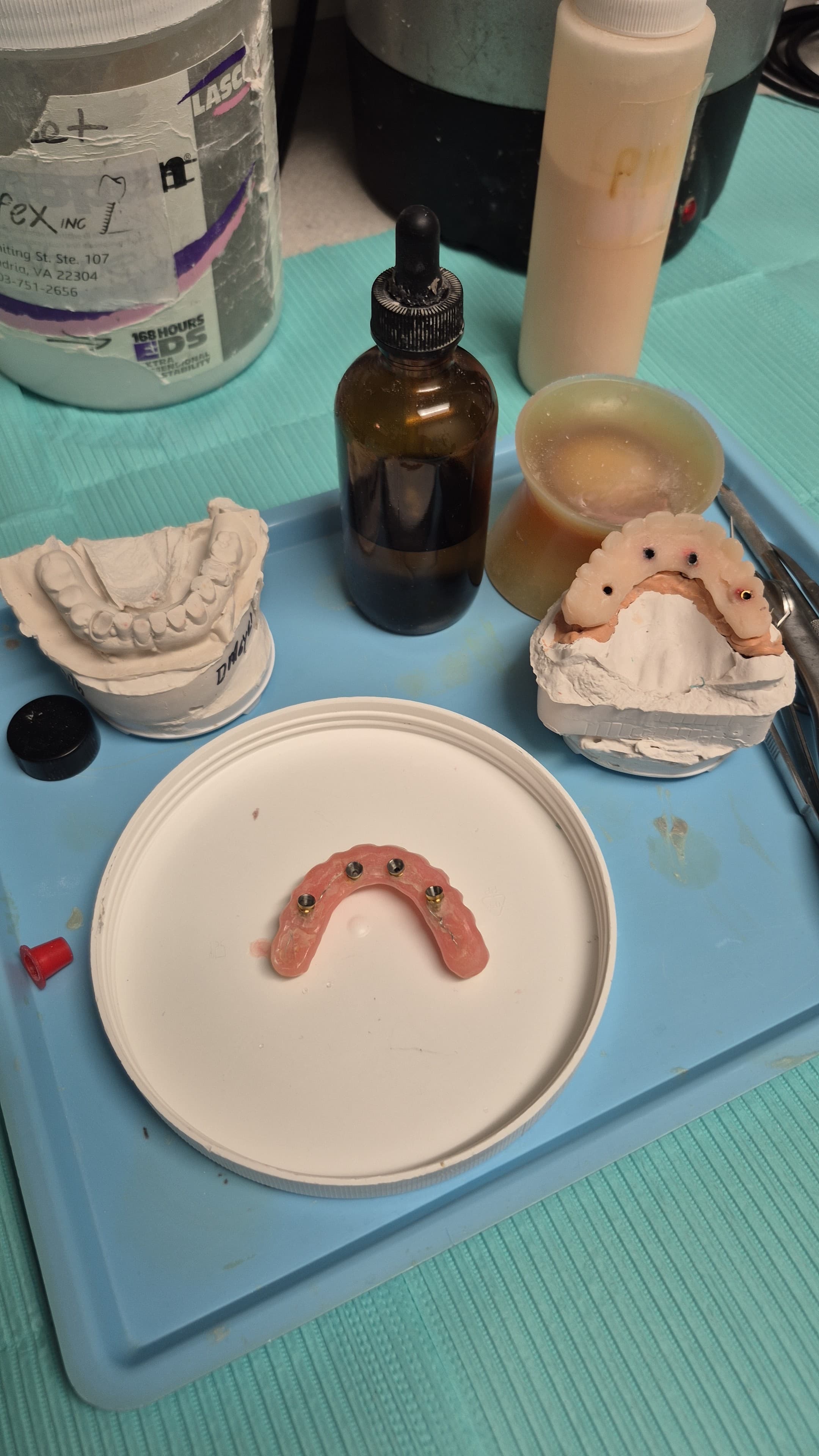 Full-Mouth Rehabilitation with Implant Support