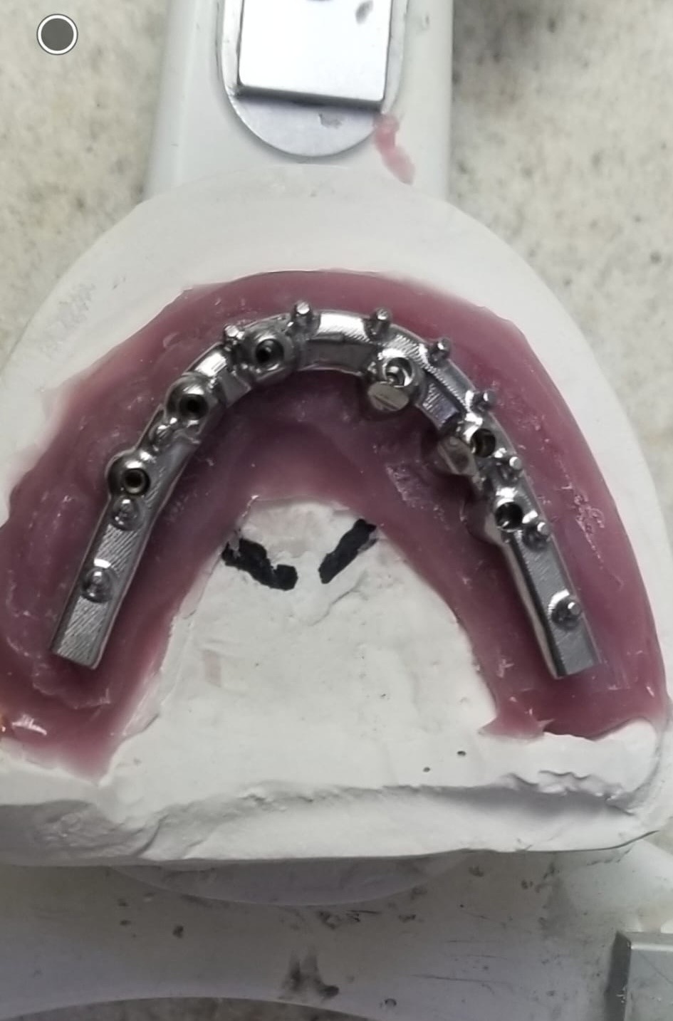 Digital Smile Design Case