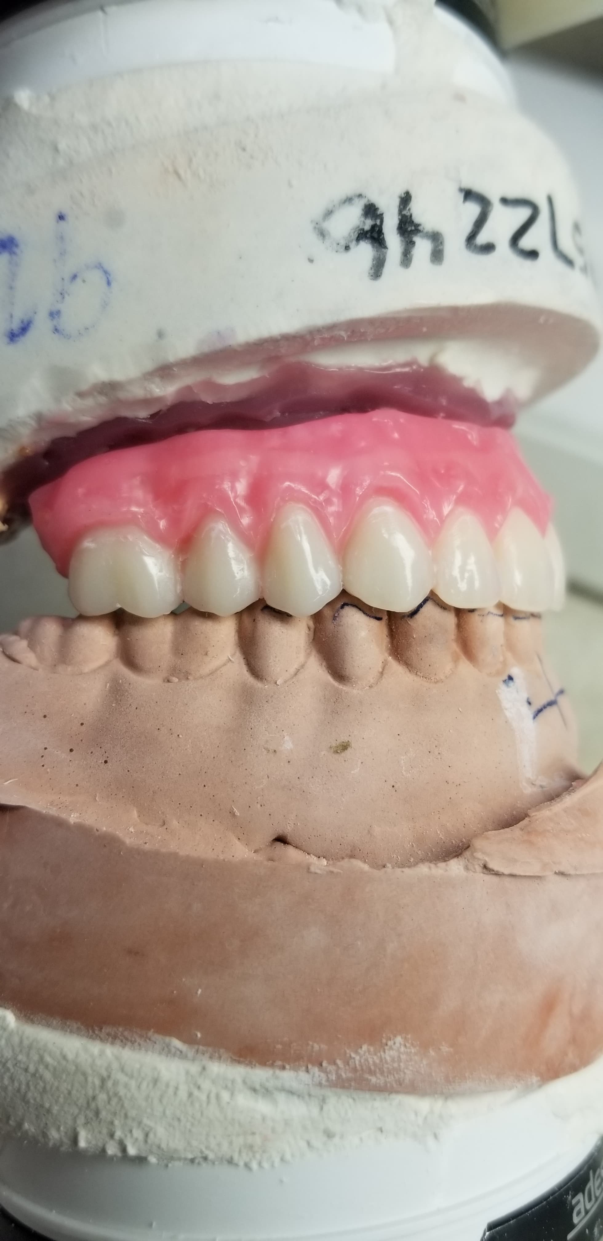 Immediate Load Protocols, Explained for the Referring Dentist