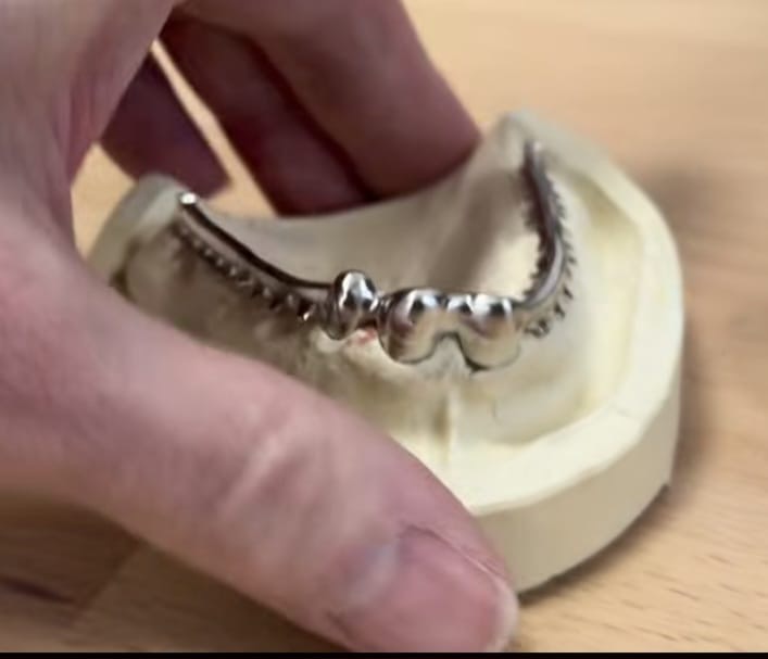 Material Selection: Zirconia, Titanium, and Crystal Ultra